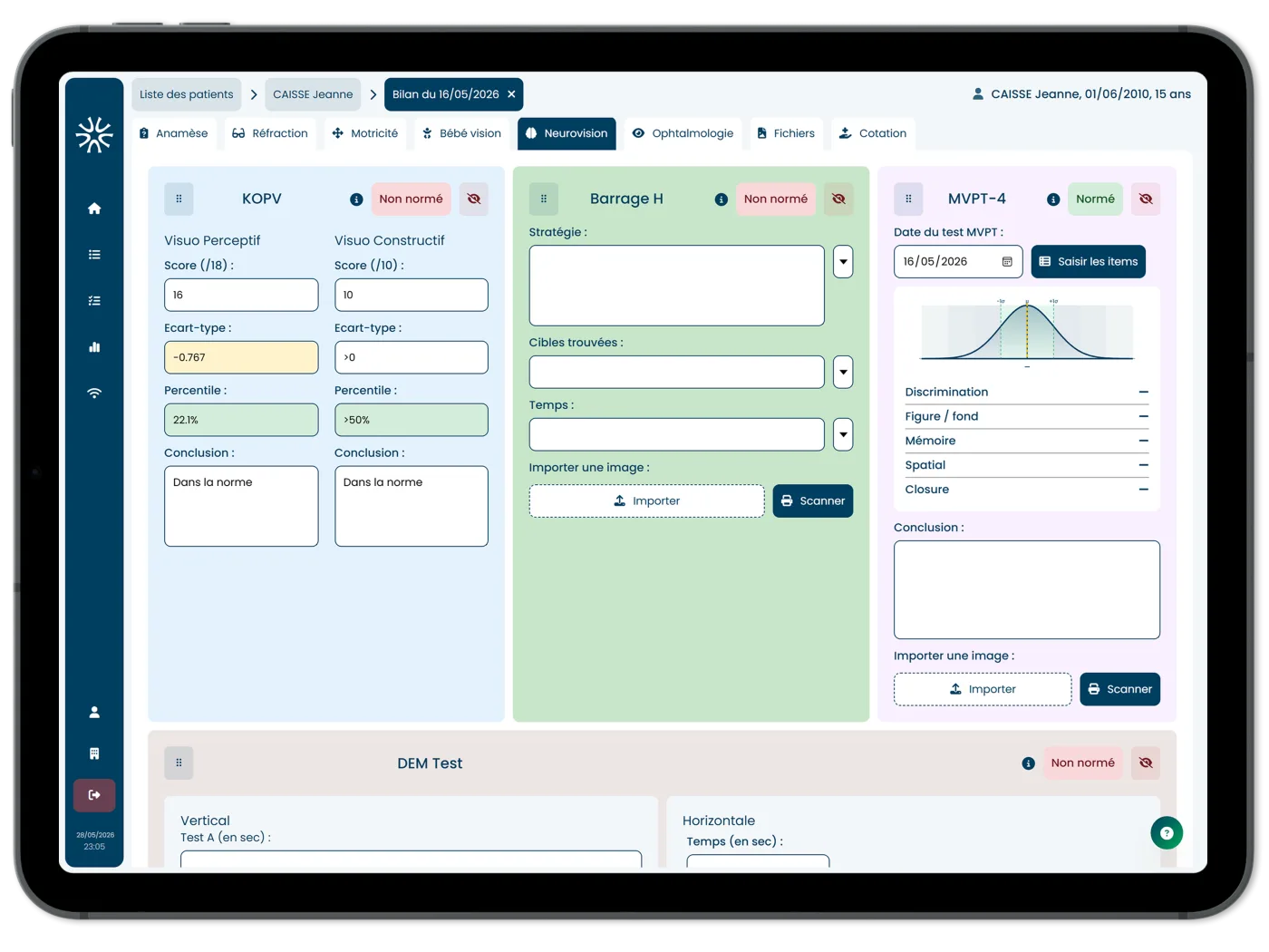 Calcul automatique du KOPV sur iPad